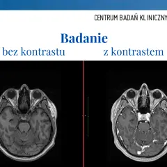Skutki uboczne po podaniu kontrastu tomografii - co warto wiedzieć?