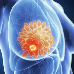 Skutki uboczne herceptyny – co musisz wiedzieć o działaniach niepożądanych