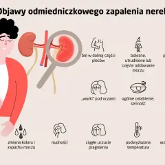 Ilustracja przedstawia objawy zapalenia nerek: ból pleców, problemy z oddawaniem moczu, obrzęki, nudności, gorączkę i inne.