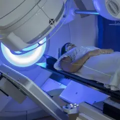 Skutki uboczne radioterapii prostaty – co warto wiedzieć i jak łagodzić objawy