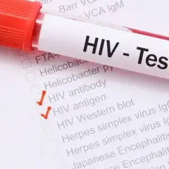 Test HIV - objawy u mężczyzn. Zaznaczone testy: przeciwciała HIV, antygen HIV, Western blot.