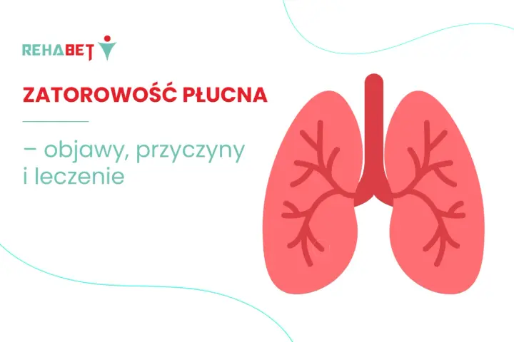 Zatorowość płucna: objawy, przyczyny i leczenie. Grafika przedstawia stylizowane płuca.