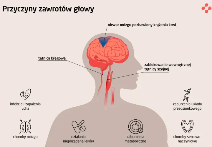 Ilustracja przedstawia przyczyny zawrotów głowy: blokadę tętnicy szyjnej, choroby mózgu, infekcje ucha, zaburzenia metaboliczne i sercowo-naczyniowe.