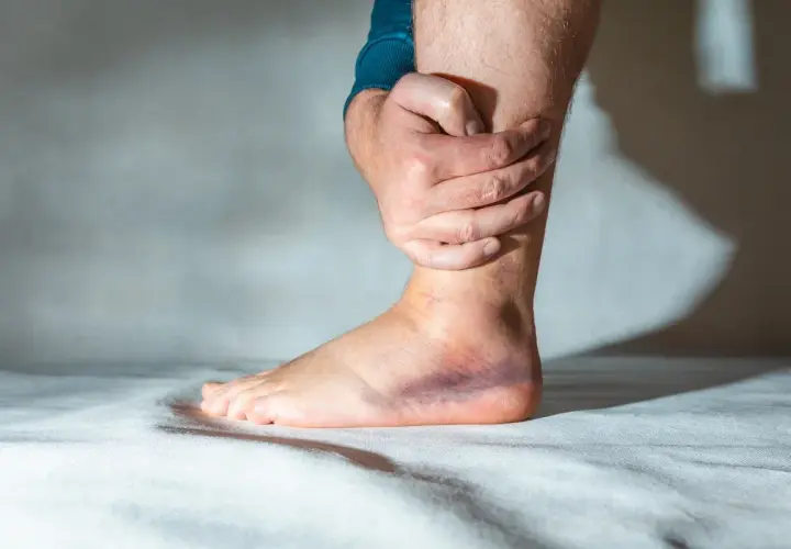 Zerwanie ATFL: Skuteczne metody leczenia i rehabilitacji