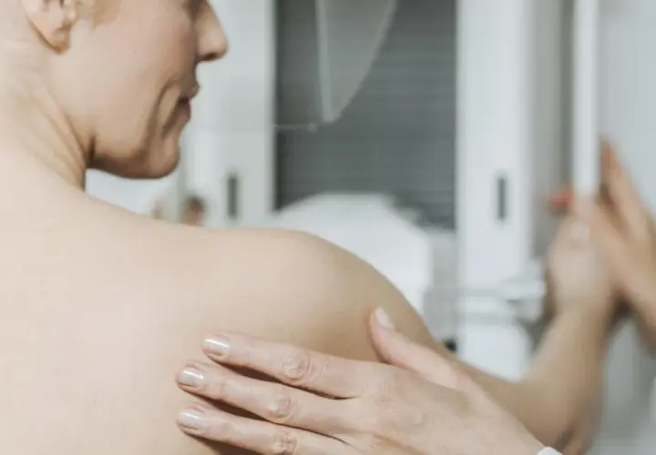 Kobieta podczas mammografii. Badanie to jest kluczowe w diagnostyce raka piersi, a leczenie często obejmuje tamoxifen.