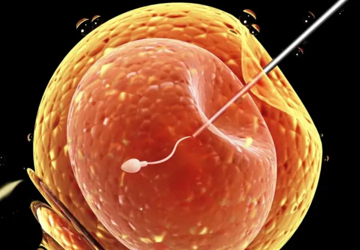 Sperm wstrzykiwany do komórki jajowej, proces wspomagany przez Ovitrelle.