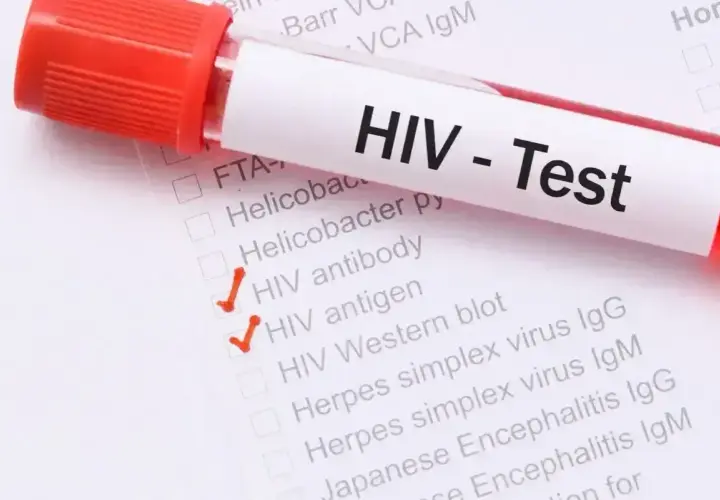 Test HIV - objawy u mężczyzn. Zaznaczone testy: przeciwciała HIV, antygen HIV, Western blot.