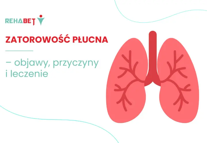 Zatorowość płucna: objawy, przyczyny i leczenie. Grafika przedstawia stylizowane płuca.