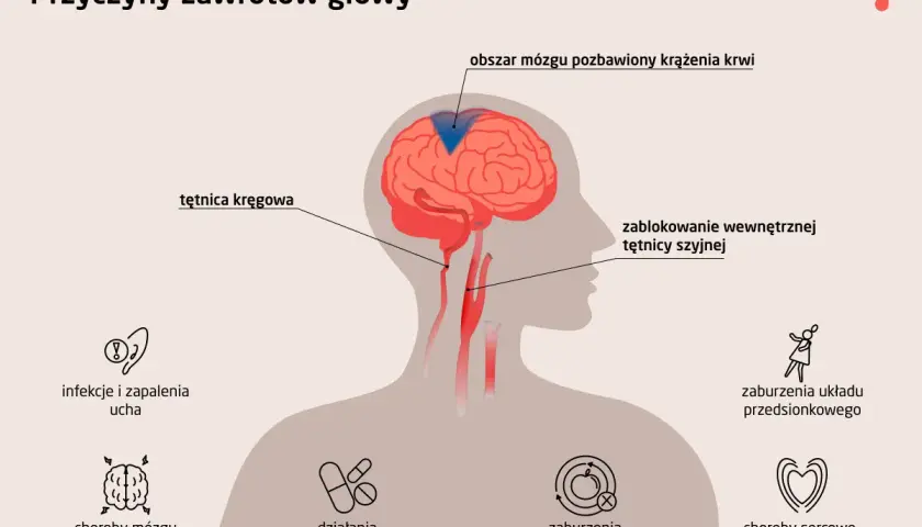 Ilustracja przedstawia przyczyny zawrotów głowy: blokadę tętnicy szyjnej, choroby mózgu, infekcje ucha, zaburzenia metaboliczne i sercowo-naczyniowe.