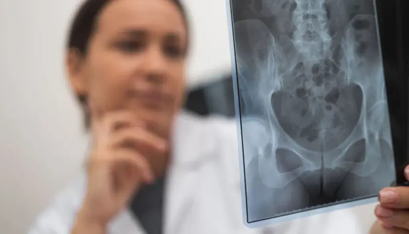 Złamane biodro: 5 kluczowych objawów, które musisz znać