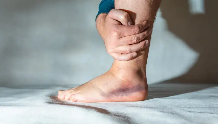 Zerwanie ATFL: Skuteczne metody leczenia i rehabilitacji