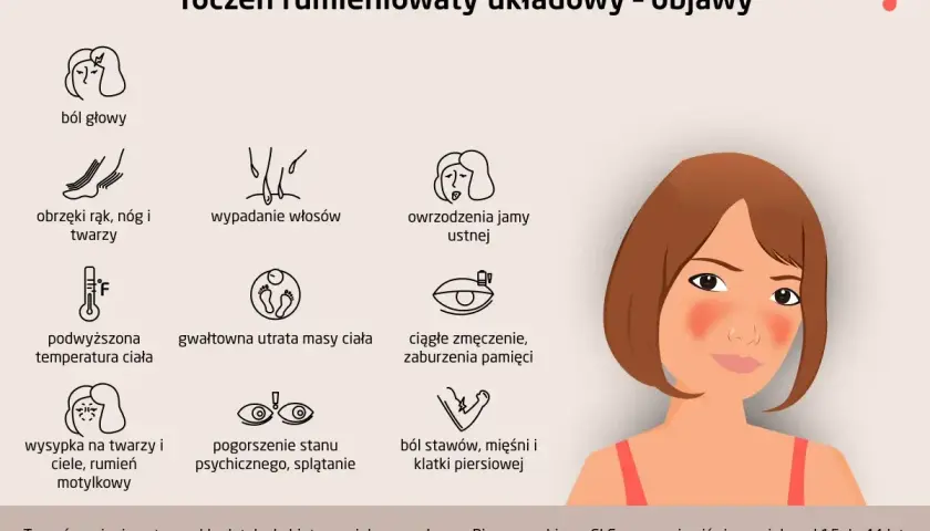 Objawy tocznia: bóle głowy, wysypka motylkowa, wypadanie włosów, owrzodzenia jamy ustnej, obrzęki, gorączka, utrata masy ciała, zmęczenie, problemy z pamięcią, bóle stawów i mięśni.