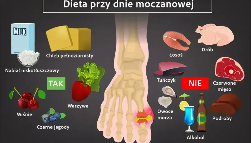Dieta przy dnie moczanowej: TAK - nabiał, chleb, warzywa, wiśnie, jagody. NIE - drób, łosoś, tuńczyk, owoce morza, czerwone mięso, podroby, alkohol.
