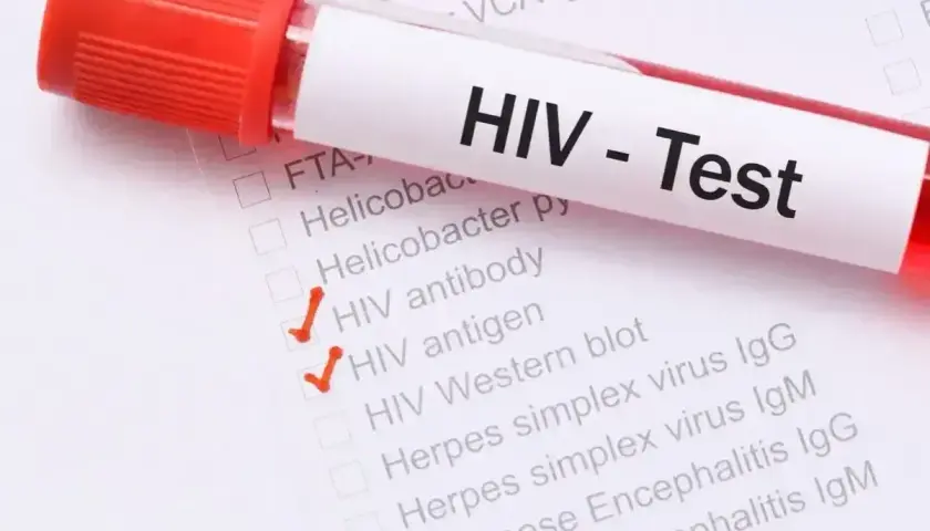 Test HIV - objawy u mężczyzn. Zaznaczone testy: przeciwciała HIV, antygen HIV, Western blot.