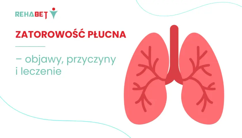 Zatorowość płucna: objawy, przyczyny i leczenie. Grafika przedstawia stylizowane płuca.
