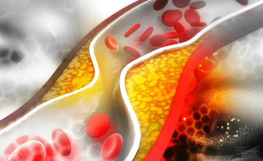 Tulip - jak bezpiecznie obniżyć cholesterol? Przewodnik po leku