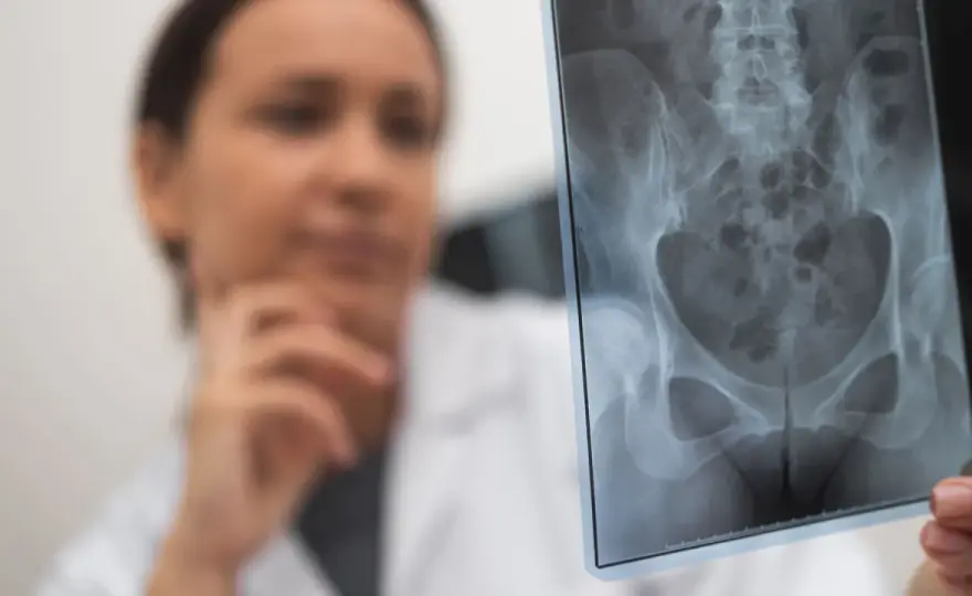 Złamane biodro: 5 kluczowych objawów, które musisz znać