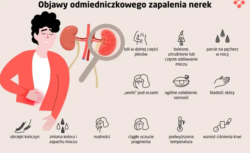 Zapalenie nerek - jak rozpoznać objawy i kiedy reagować?