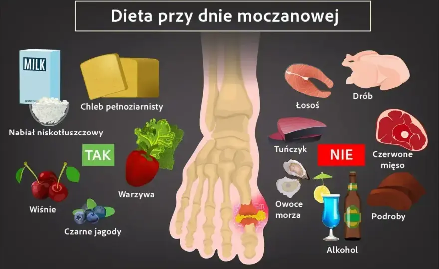 Milurit - na co jest? Prawda o kwasie moczowym i dnie