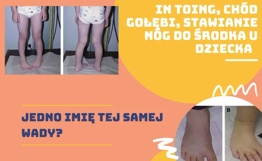 Gołębi chód u dzieci: przyczyny, objawy i skuteczne leczenie