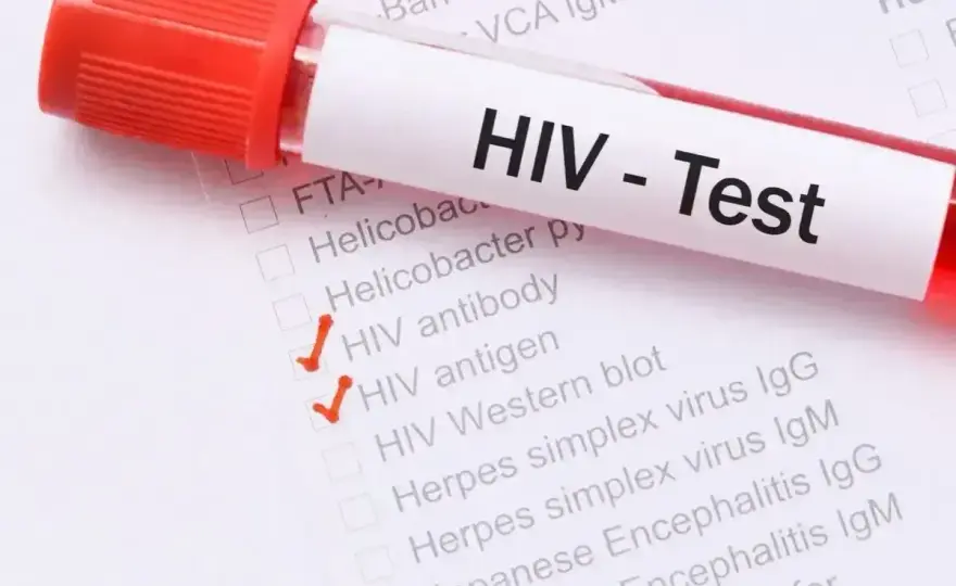 Objawy HIV u mężczyzn - Czy to grypa? Sprawdź, kiedy test!