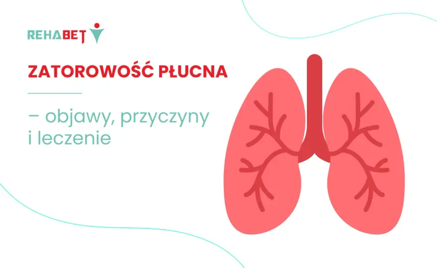 Zatorowość płucna - objawy, które ratują życie. Sprawdź!