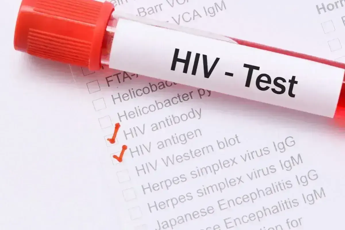Test HIV - objawy u mężczyzn. Zaznaczone testy: przeciwciała HIV, antygen HIV, Western blot.