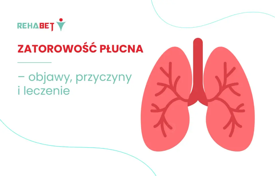 Zatorowość płucna - objawy, które ratują życie. Sprawdź!